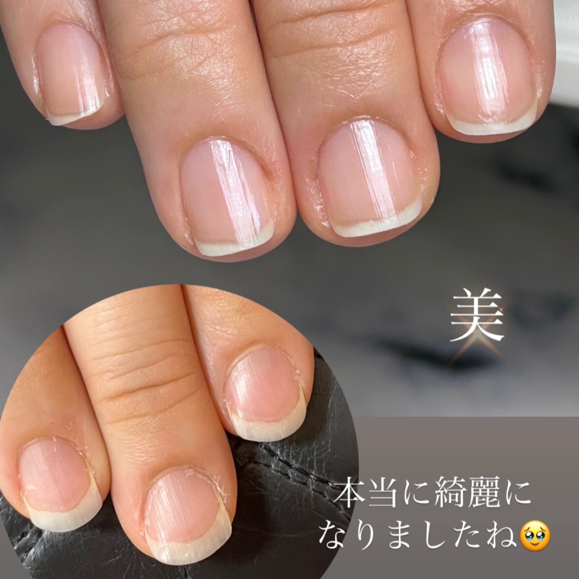 初めての方でも安心！ビフォーアフター掲載中｜筑後市のネイルケアならLumirise